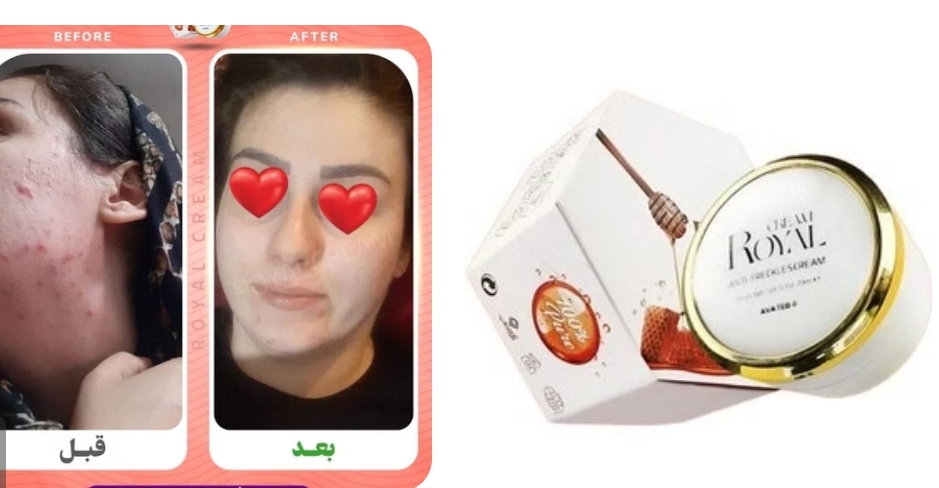 کرم رویال با ضمانت اورجینال