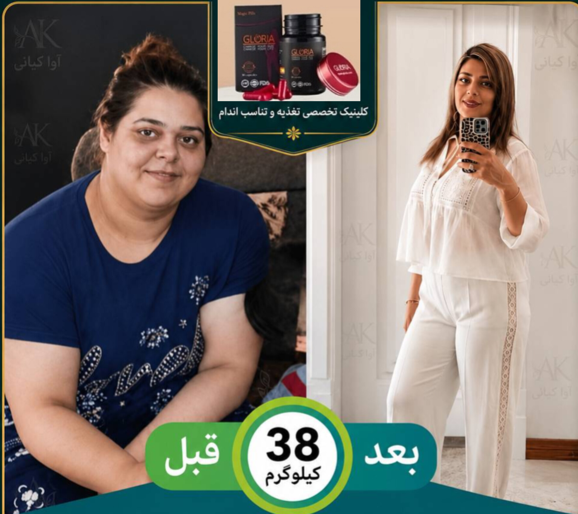 قرص لاغری گلوریا درب قرمز (کپسول قرمز) (Gloria) کم کننده اشتها و کاهش عالی علاقه به خوردن را کاهش می دهد. قرص لاغری gloria برای افرادی که استرس و اضطراب در پور خوری آنها تاثیر بالای دارد گزینه عالی می باشد.. گلوریا با مهار بازجذب نوراپی نفرین و سروتونین و به مقدار کمتر دوپامین در مغز، باعث کاهش اشتها می‌شود.  قرص لاغری گلوریا درب قرمز (کپسول قرمز) (Gloria) در کاهش وزن افرادی که قادر به گرفتن رژیم های غذایی کم کالری و ورزش نیستند بسیار موثر می باشد. کپسول لاغری گلوریا  gloria به شما کمک میکند که با مصرف غذای کمتر احساس بهتری داشته باشید و به عبارتی میزان غذای مصرفی شما را کنترل میکند.